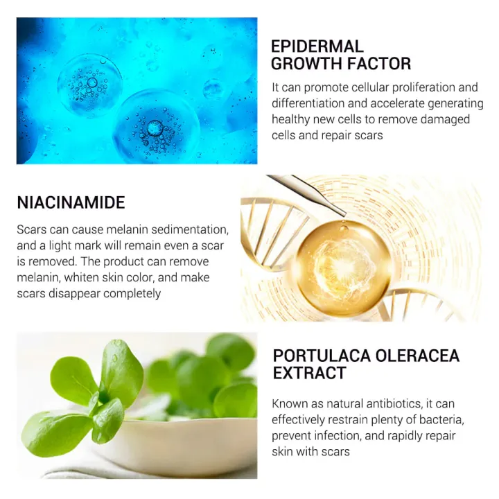 Breylee%20Skin%20Repair%20Acne%20Cream%20-%2030g%20-%20Image%205