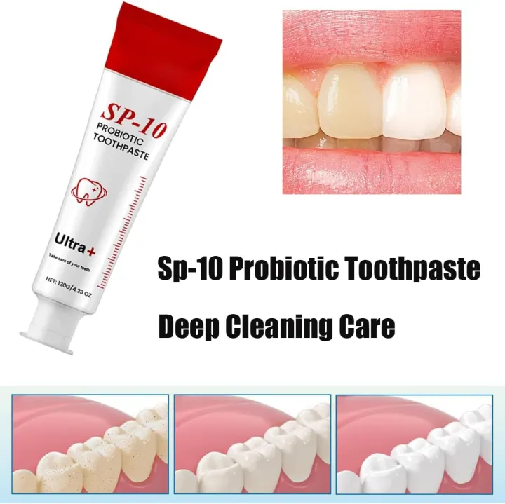 Sp-10%20Probiotic%20Toothpaste,Whitening%20Toothpaste,Fresh%20Breath,Deep%20Cleaning%20Care%20-%20Image%208