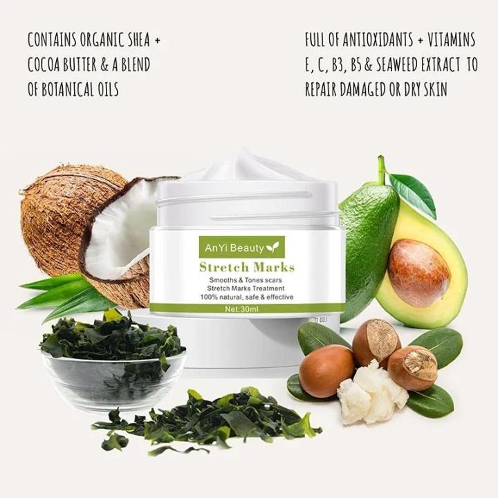 Pregnancy%20Stretch%20Mark%20Repair%20Cream%20Stretch%20Scar%20Marks%20Remover%20Maternity%20Obesity%20Treatment%20Body%20Postpartum%20Smooth%20Skin%20Care%20-%20Image%203