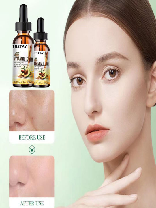 TRSTAY%20vitamin%20E%20essence%20oil%20shrinks%20pores,%20reduces%20fine%20lines,%20nourishes%20skin,%20and%20cleans%20face%20-%20Image%202