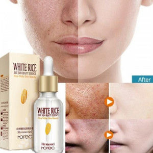 White%20Rice%20face%20Serum%20skin%20care%20-Wrinkles%20Dark%20Spots%20&%20anti-aging%20Sun%20Damage%20Corrector-15ml%20-%20Image%203