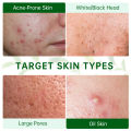 Acne Treatment Facial Mask Natural Tea Tree Pore Cleaning Blackhead Remove Oil Control Pimple Skin Care Products Face Clay Mask KKhao.