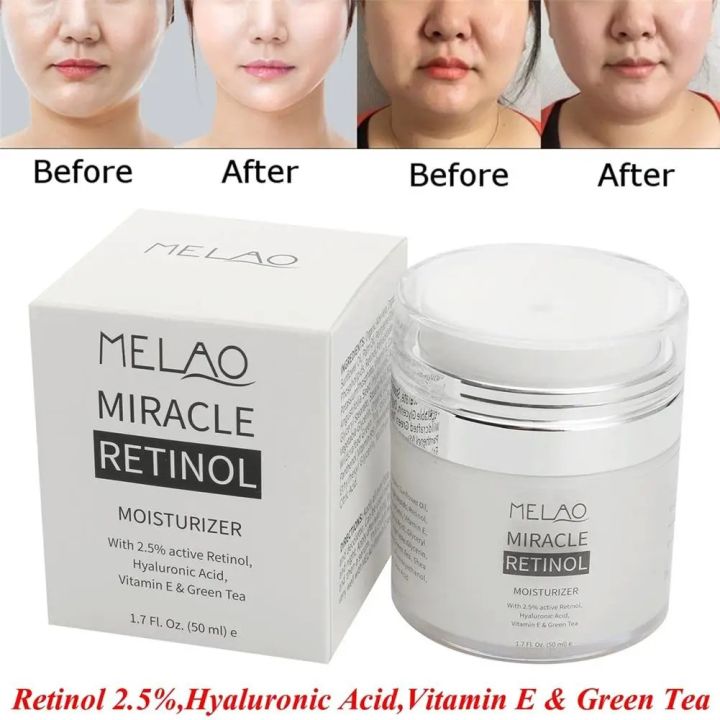 MELAO%202.5%25%20Retinol%20Moisturizer%20Cream-50ml%20-%20Image%204