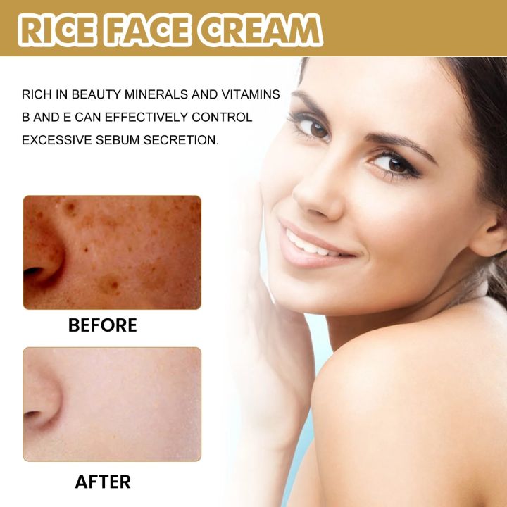 White%20Rice%20Face%20Cream%20Lighten%20Dark%20Spots%20Freckle%20Remove%20Melanin%20Improve%20Fine%20Lines%20Pore%20Refining%20Whitening%20Brightening%20Skin%20Care%20-%20Image%205