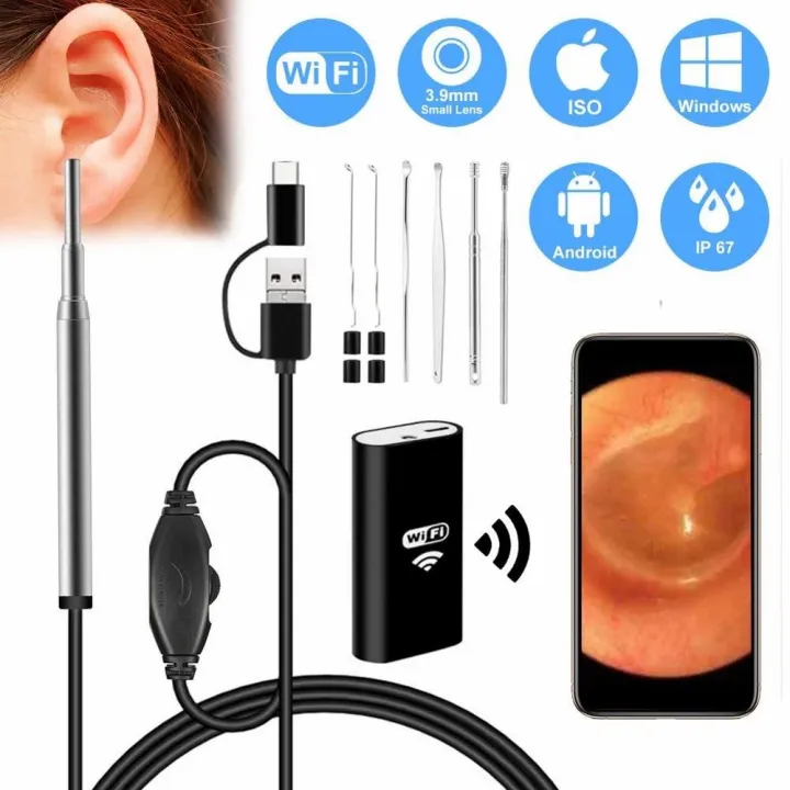 USB%20Otoscope-Ear%20Endoscope%20Diameter%20Visu%20Waterproof%20HD%20Ear%20Camera%20with%20Ear%20Tool%20and%206%20Adjustable%20LED%20Lights%20for%20-Android%20and%20Windows%20-%20Image%208