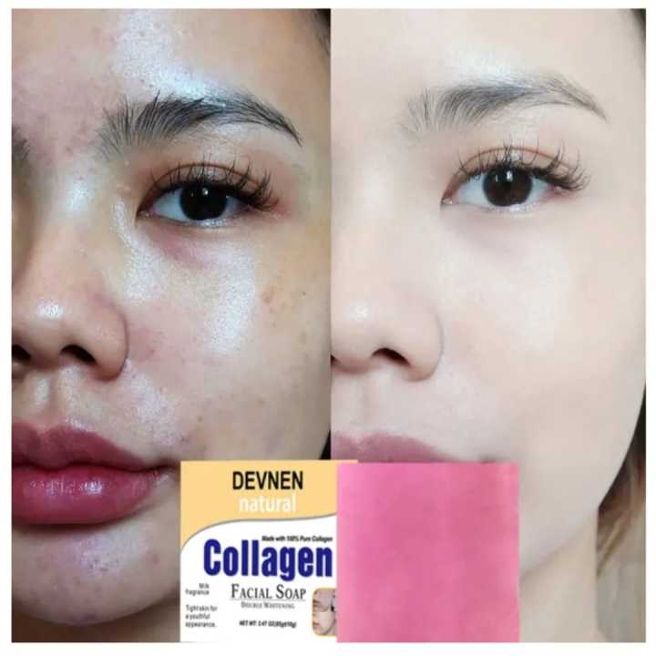DEVNEN%20COLLAGEN%20PLUS%20soap%20vitamin%20C%20and%20E%20Brightening%20vitamin%20C%20and%20E%20Brightening%20Natural%20Double%20Whitening,%20Skin%20Firming%20Natural%20Collagen%20Facial%20Soap%20-%20Image%208