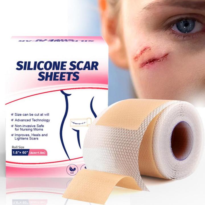 1pcs%20150cm%20Silicone%20Gel%20Scar%20Sheet%20Patch%20Treatment%20Removal%20Tape%20Acne%20Trauma%20Burn%20Scar%20Cover%20Skin%20Repair%20Section%20Ear%20Beauty%20-%20Image%203