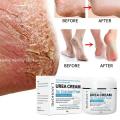 40% Foot Urea Cream Foot Peeling Spray Scrub Exfoliating Cream Heel Cracked Repair Cream Removal Dead Skin Hand Feet Care. 