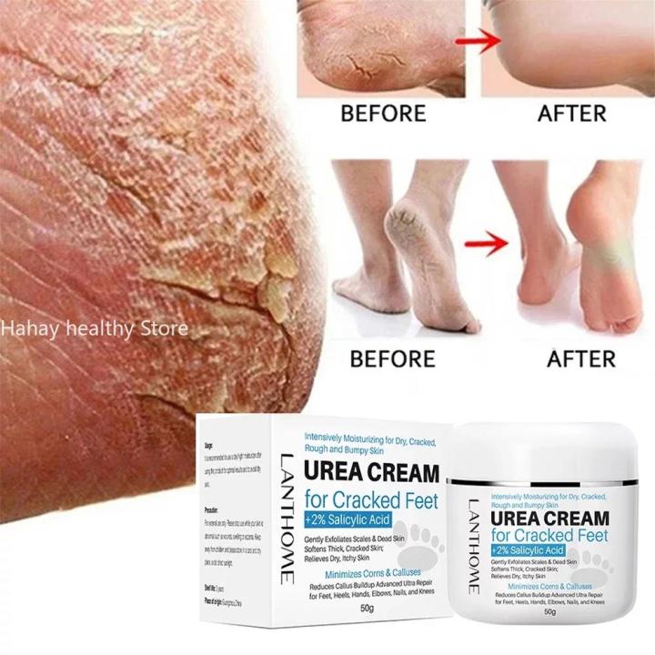 40%25%20Foot%20Urea%20Cream%20Foot%20Peeling%20Spray%20Scrub%20Exfoliating%20Cream%20Heel%20Cracked%20Repair%20Cream%20Removal%20Dead%20Skin%20Hand%20Feet%20Care%20-%20Image%203