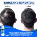 Kirkland Minoxidil 5% Topical Solution 60ml Extra Strength Hair Regrowth Treatment for Men Dropper Applicator Included. 