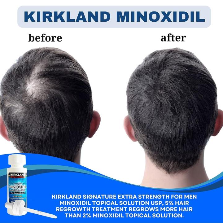 Kirkland%20Minoxidil%205%25%20Topical%20Solution%20USP%2060ml%20Unscented%20Strength%20Hair%20Regrowth%20Treatment%20for%20Men%20Dropper%20Applicator%20Included%20-%20Image%203