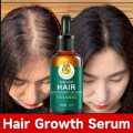 100% Natural Ginger Hair Serum Hair Grower Fast Long Hair Treatment Minoxidil Hair Grower Castor Oil For Essence Preventing Baldness Consolidate Hair Loss Treatment repairs the hair improves hair loss hair growth serum 10 x faster. 