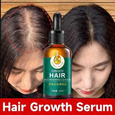 100% Natural Ginger Hair Serum Hair Grower Fast Long Hair Treatment Minoxidil Hair Grower Castor Oil For Essence Preventing Baldness Consolidate Hair Loss Treatment repairs the hair improves hair loss hair growth serum 10 x faster