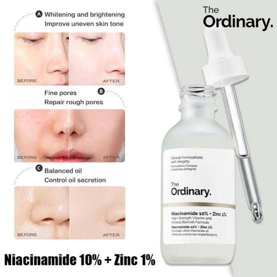 Niacinamide%2010%25%20+%20Zinc%201%25%20Serum%20%E2%80%93%2030ml%20-%20Image%204
