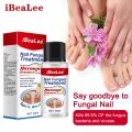 Nail Fungus Treatment 7 Day Repair Potion Essence Anti Infective Onychomycosis Nail Fungus Removal Gel Foot Care. 