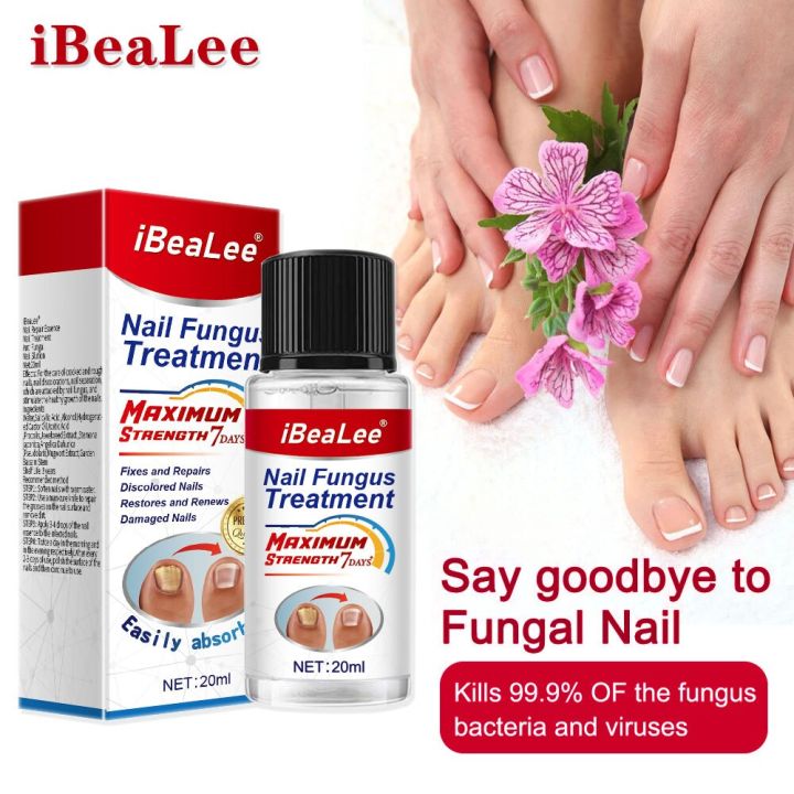 Nail%20Fungus%20Treatment%207%20Day%20Repair%20Potion%20Essence%20Anti%20Infective%20Onychomycosis%20Nail%20Fungus%20Removal%20Gel%20Foot%20Care%20-%20Image%202