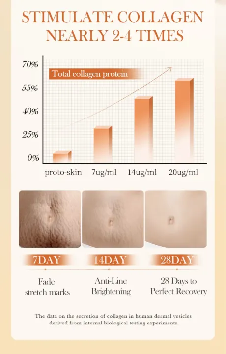 SADOER%20Oats%20&%20Amino%20Acid%20Stretch%20Mark%20Cream%2040gm%20For%20Pregnancy%20Repair%20Scar,%20Hydrates%20and%20Soothes%20&%20Reduces%20Stretch%20Marks%20-%20Image%207