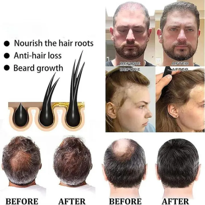 Hair%20Nourishing%20Shampoo%20soap%20Polygonum%20hair%20darkening%20shampoo%20bar%20soap%20natural%20organic%20hair%20cleansing%20handmade%20soap%20hair%20halal%20-%20Image%208