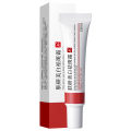 Face Dark Spots Remover for Women Remove Melasma Freckles Cream Removal Melanin Whitening Cream Fade Spots Skin Brightening Care.