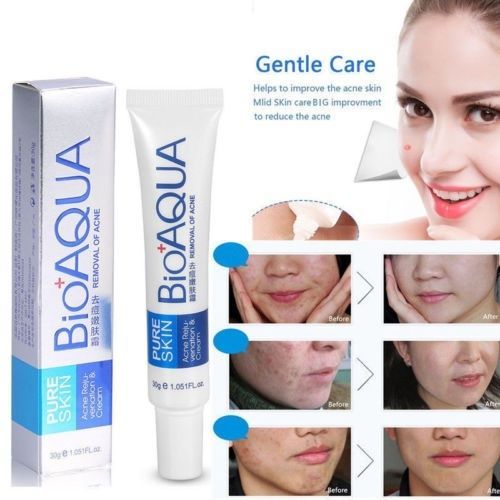 BIOAQUA Pure Skin Acne Rejuvenation Cream - 30g | Daraz.com.bd