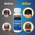 Kirkland Minoxidil 5% Topical Solution Extra Strength Beard & Hair Regrowth Treatment 60ml 1 Month Supply - 100% Original - MNXMC. 
