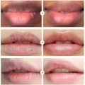 Lip Lightening Dark Lips Bleach Lips Whiten Remove Dull Black Lip Deep Nourish Fade Lip Lines Moisturize Bright.