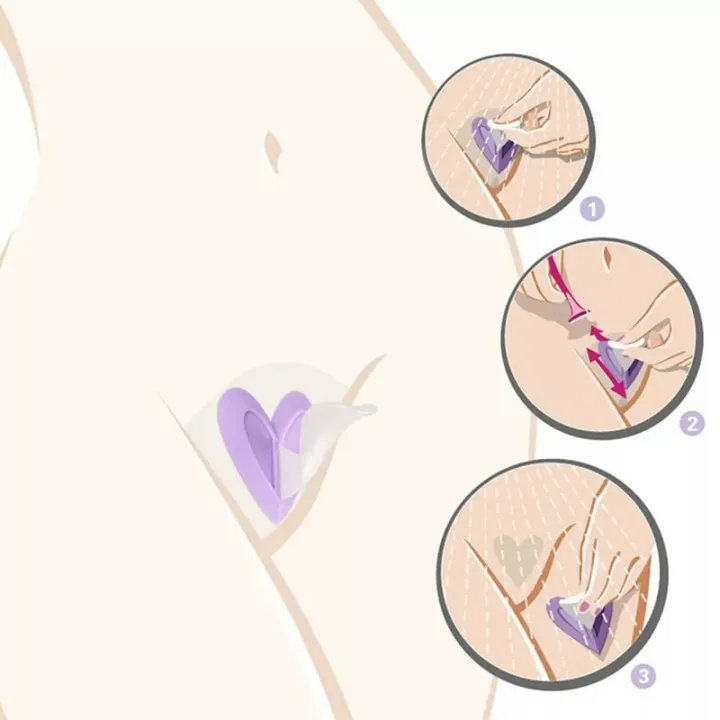 Female%20pubic%20hair%20trimming%20toolsshaver%20bikini%20private%20epilator%20plastic%20surgery%20template%20razor%20shaver%20-%20Image%203