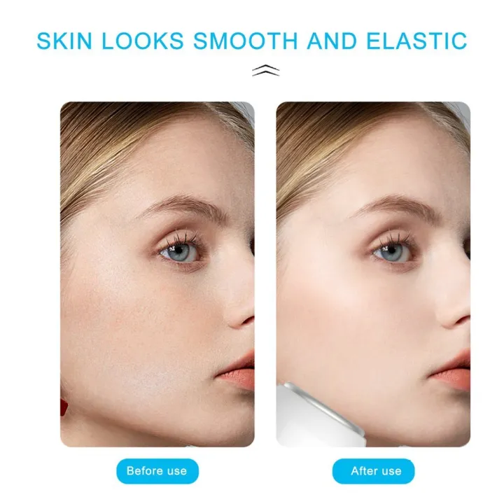 %E3%80%90The%20Edge%20of%20Beauty%E3%80%91New%20Face%20Cool%20Ice%20Roller%20Maager%20Lift%20kin%20Lifting%20Tool%20-%20Image%206