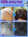 White hair killer, remove gray hair and restore natural hair color in 7 days. 