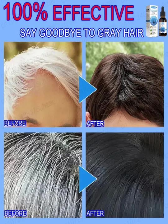 White%20hair%20killer,%20remove%20gray%20hair%20and%20restore%20natural%20hair%20color%20in%207%20days%20-%20Image%202