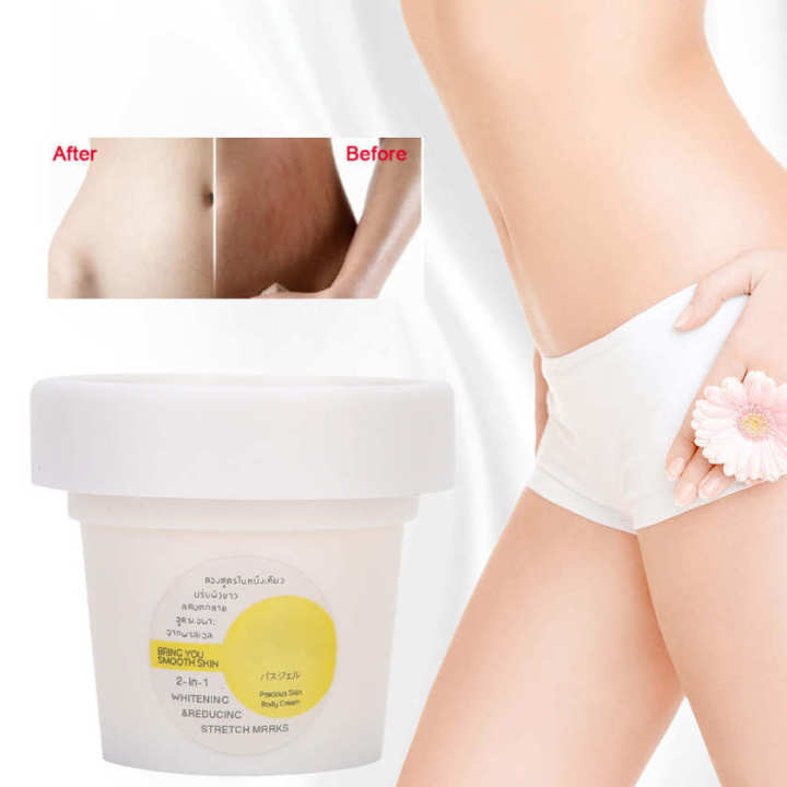 Stretch%20Repair%20Cream%20Remover%20Removal%20Pregnancy%20Postpartum%20Treatment%20Skin%20Repairing%20Tool%20-%20Image%206