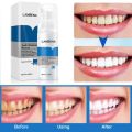 LANBENA Teeth Whitening Mousse Tooth Whitening Dental Tool Cleaning White Teeth Oral Hygiene Toothpaste Bleaching Remove Stains-60gm. 