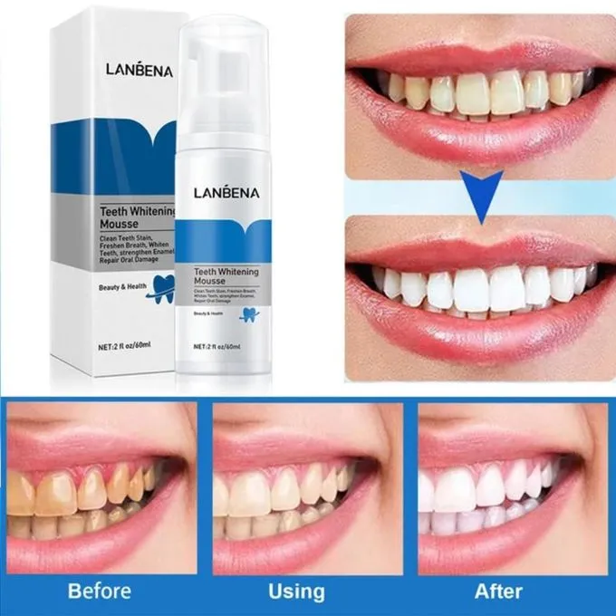 LANBENA%20Teeth%20Whitening%20Mousse%20Tooth%20Whitening%20Dental%20Tool%20Cleaning%20White%20Teeth%20Oral%20Hygiene%20Toothpaste%20Bleaching%20Remove%20Stains-60gm%20-%20Image%202