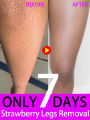Keratosis Pilaris Removal Cream for Strawberry Legs Hydrating, moisturizing, deep cleansing rough body skin exfoliating scrub.