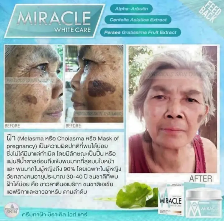 Miracle%20lntense%20White%20Night%20Cream%2020%20MI%20-%20Image%204