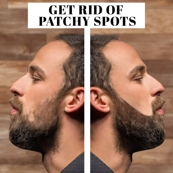 Zgts%20Derma%20Roller%200.5mm%20-%20192%20Titanium%20For%20Skin%20Hair%20And%20Beard%20Growth%20(All%20Sizes%20Available)%20-%20Image%208