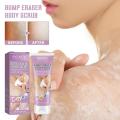 Keratosis Pilaris Removal Cream for Strawberry Legs Hydrating, moisturizing, deep cleansing rough body skin exfoliating scrub.