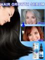 White hair killer, remove gray hair and restore natural hair color in 7 days. 