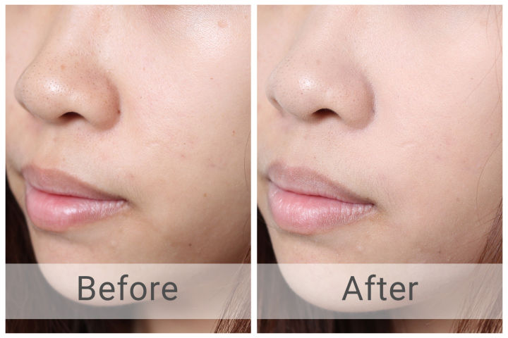 Assure%20Complexion%20%20Bar%20Soap%20Honey%20%20kesor%20&%20olive%20oil%20enriched75g%20India%20-%20Image%203