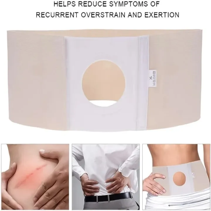 Colostomy%20Ostomy%20Abdominal%20Belt%20Medical%20Stoma%20Support%20Ostomy%20Hernia%20Belt%20with%20A%20Hole%20Elastic%20Breathable%20Pain%20Relief%20-%20Image%202