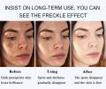 Dark spot remover cream, lightening body lotion, lightening melanin repair, moisturizing polish, quick shine, anti-fouling, skin care, Korean cosmetics. 
