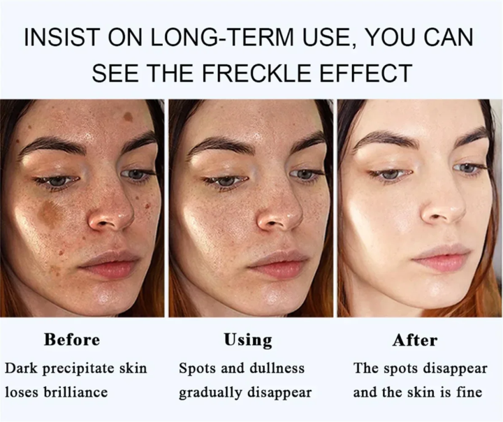 Dark%20spot%20remover%20cream,%20lightening%20body%20lotion,%20lightening%20melanin%20repair,%20moisturizing%20polish,%20quick%20shine,%20anti-fouling,%20skin%20care,%20Korean%20cosmetics%20-%20Image%202