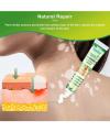 Vitiligo Treatment Cream Healthy White Spot Therapeutic Gel. 