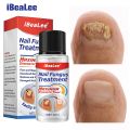 Nail Fungus Treatment 7 Day Repair Potion Essence Anti Infective Onychomycosis Nail Fungus Removal Gel Foot Care. 