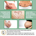 Jaysuing Pregnancy Repair Spray Fade Pregnant Women Pregnancy Fine Lines Postpartum Skin Pregnancy Lines Care Spray. 