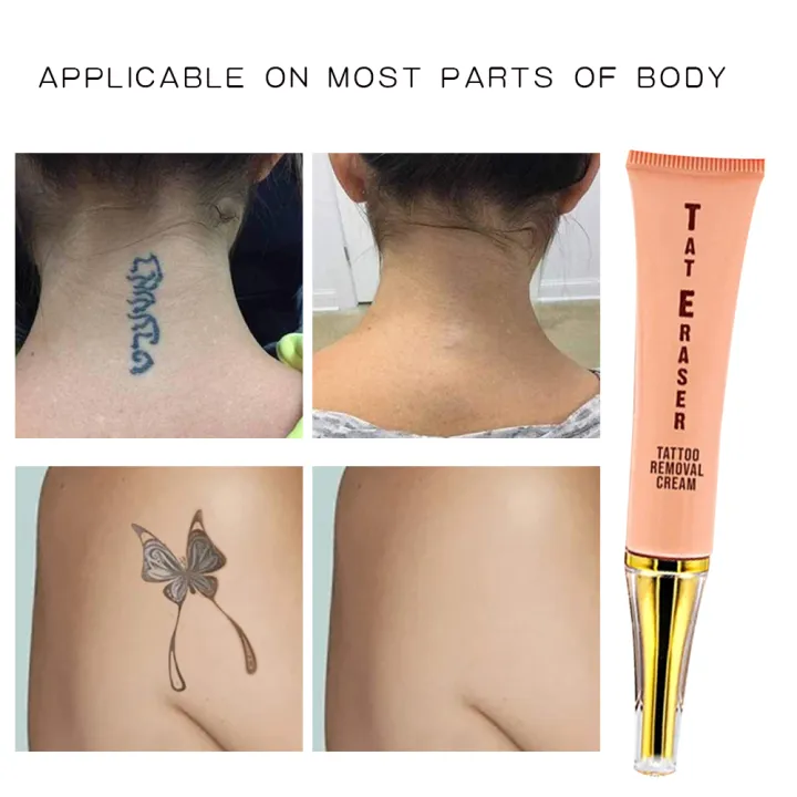 %E3%80%90Big-promotion%E3%80%91%20New%20Permanent%20Tattoo%20Removal%20Cream%20afe%20Moiturize%20kin%20Tattoo%20Remover%20Gel%20No%20Need%20For%20Pain%20Removal%20Maximum%20trength%20Tattoo%20Tool%20-%20Image%207