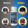 Kirkland Minoxidil 5% For Beard & Hair Growth. 
