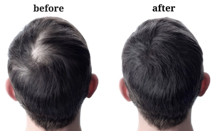 Hair%20Guard%20Oil-100ml.%20for%20your%20Natural%20Hair%20Fall%20Solution%20-%20Image%204