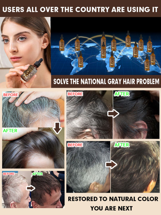 Gray%20Hair%20Treatment%20Serum%20Fast%20White%20To%20Black%20Repair%20Natural%20Color%20Nourish%20KKhao%20-%20Image%203