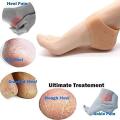 CIM- Anti Crack Half and Full Length Silicone Foot Protector Moisturizing Socks for Foot-Care and Heel Cracks for Men and Women - (Free Size) (Heel Socks). 